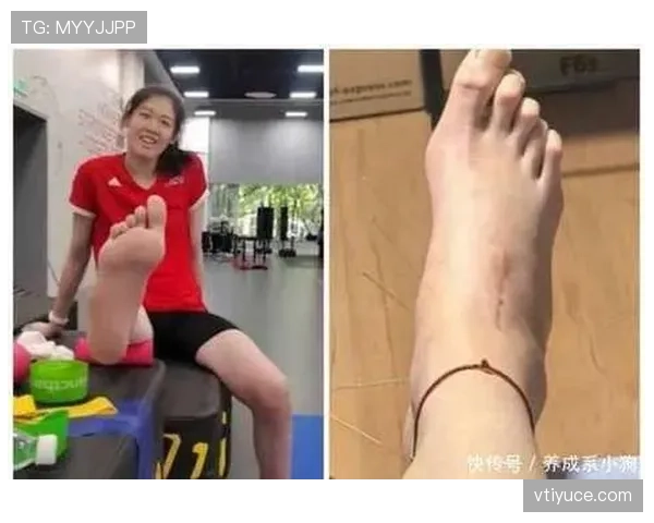 李盈莹训练完直接啃鸡腿,这自律和放纵切换得也太真实了 李盈莹训练完直接啃鸡腿,这自律和放纵切换得也太真实了